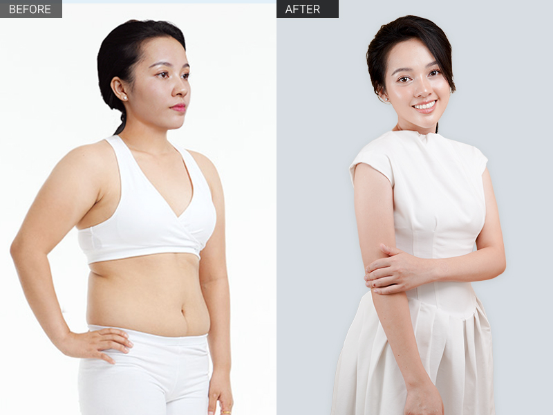 Giảm béo bụng cho dân văn phòng tại Hóc Môn